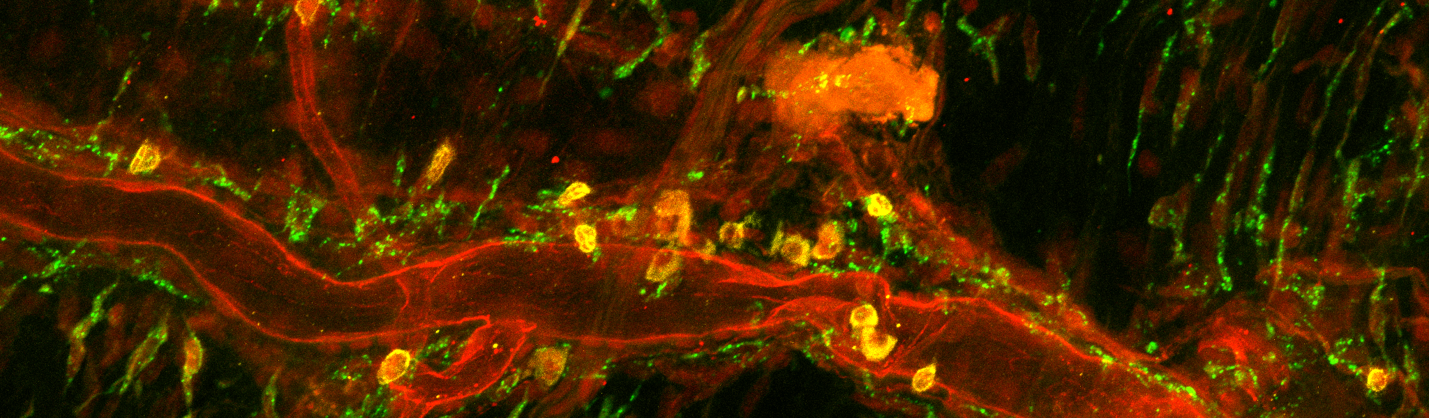 Immune cells along cerebral vasculature