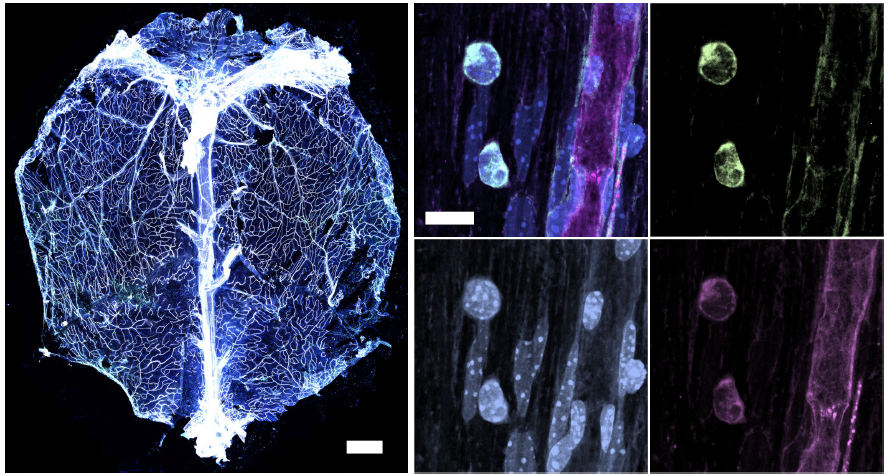 Fluorescence microscopy from the Kigar lab